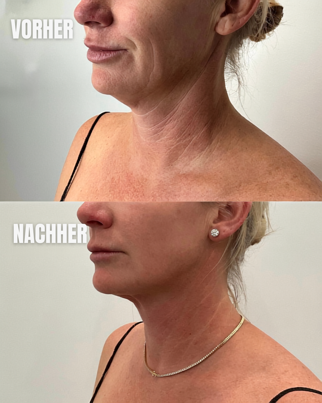 Tech-Neck Creme