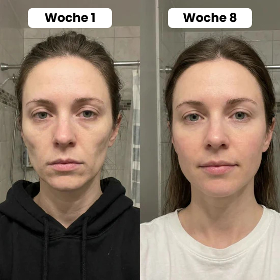 Volume Lift Balm