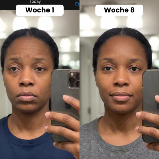 Volume Lift Balm