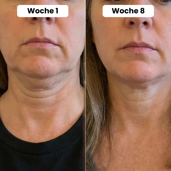 Volume Lift Balm